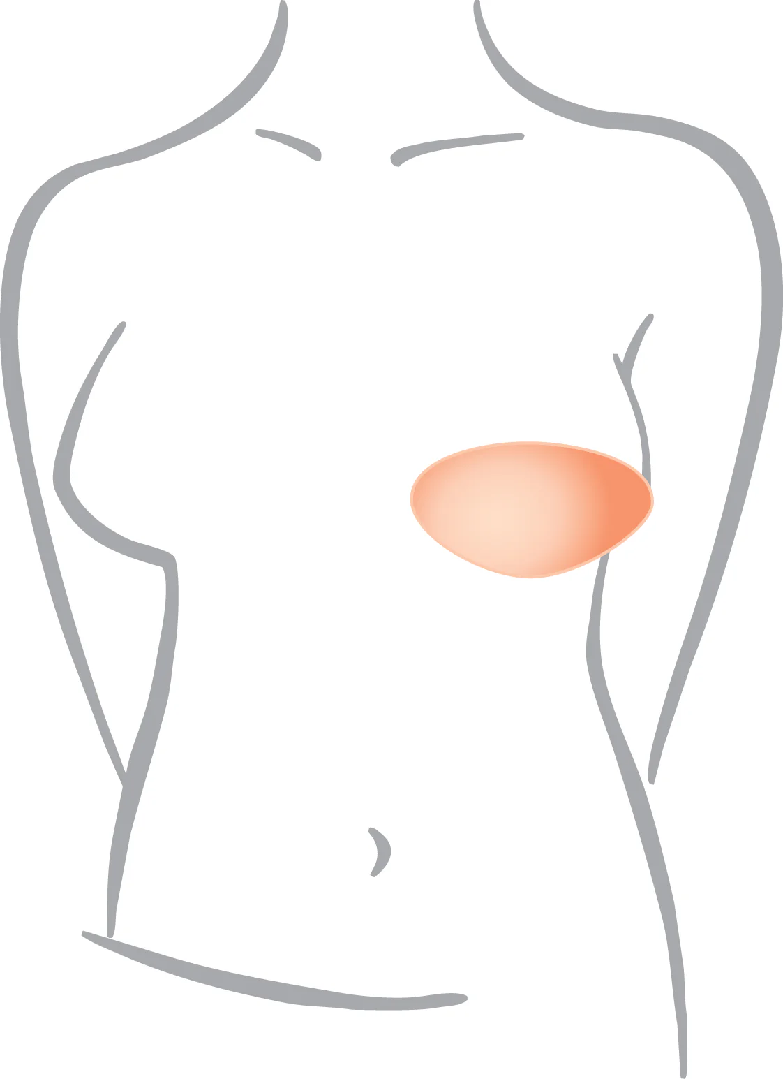 Amoena Balance Natura Varia Partial Breast Shaper - SV285 - Image 3